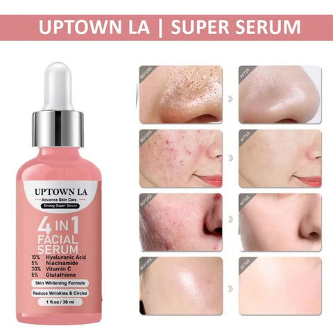 UPTOWN LA 4-in-1 Super Skin Glowing Serum | Niacinamide 5% + Vitamin C 30% + Vitamin E 10% + Hyaluronic Acid | Brightening, Dark Spots, Hydration | 30ml